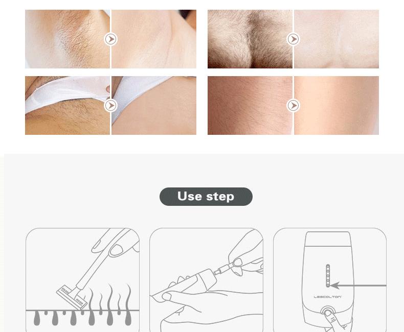 Laser Hair Removal - Sissy Panty Shop