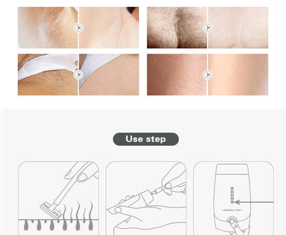 Laser Hair Removal - Sissy Panty Shop